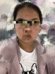 -E.beauty驻颜·痘敏肌调理中心