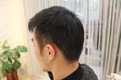 点击看大图 -大麦微针植发丨全国连锁