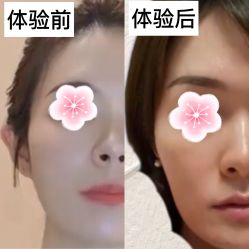 体验前-北京爱育华医院-医疗美容科