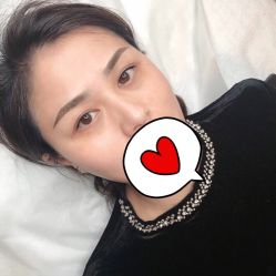 点击看大图 -西施无菌半永久纹绣眉眼影唇轻增发纹发际线