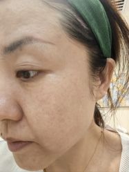 -海涛医疗美容·面部抗衰·注射美鼻