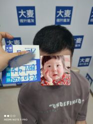 体验后-大麦微针植发丨全国连锁
