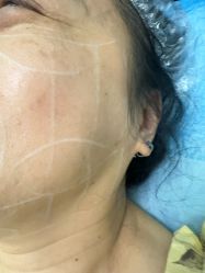 -长沙雅美医疗美容医院