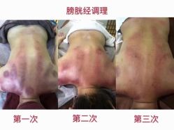 点击看大图 -升艾堂亚健康调理中心