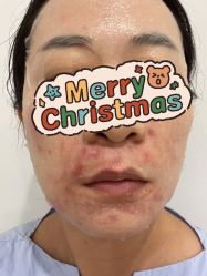 体验前-北京米扬丽格医疗美容·联合丽格鼻整形中心