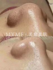 -美愈美肤MEIYU SKIN