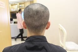 -大麦微针植发丨全国连锁