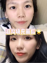 -天津健丽·去眼袋医疗美容机构