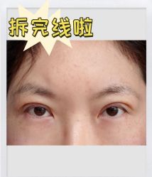 -素美医疗美容·西南眼鼻整形·修复基地