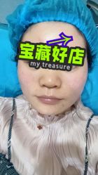 体验后-重庆联合丽格第五医疗美容医院