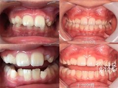 -Dr.Z dental仁康种植矫正中心