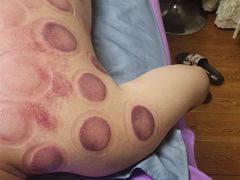 -沈师傅盲人按摩工作室(密三小区店)