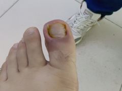 -新甲连锁灰指甲·甲沟炎·鸡眼(黑龙江路店)