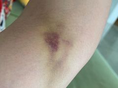 -美年大健康体检中心(西直门分院)