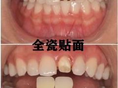 -团圆口腔·种植中心(锦江院区)