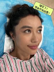 -碧莲盛·不剃发植发