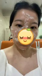 体验前-Yestar 嘉兴艺星医疗美容医院
