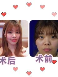 -广东韩妃整形外科医院