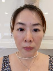 体验后-大华韩艺整形美容医院