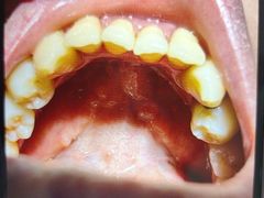 -土豆口腔(凤凰北总店)