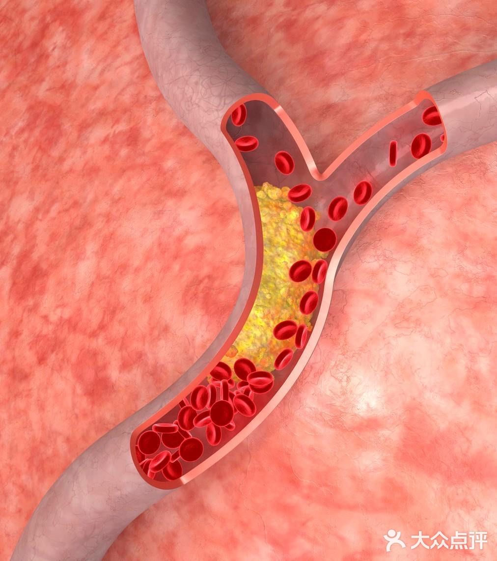 护血管、促循环，受益一辈子