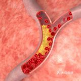 护血管、促循环，受益一辈子