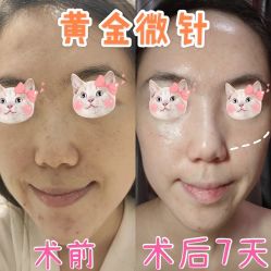 -洁铭新加坡医美