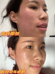 点击看大图 -八大处整形