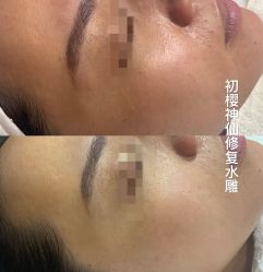 -初樱科技美学问题肌修复中心