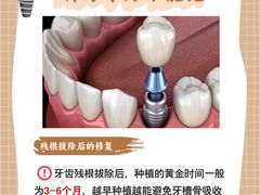 -上海仁爱医院口腔科 · 种植