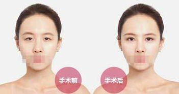 -SKINIST丽铂医疗美容