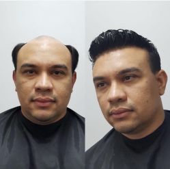 -发饰美男士增发补发假发定制店