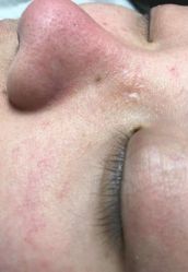 点击看大图 -莱尚·皮肤管理·痘肌护理