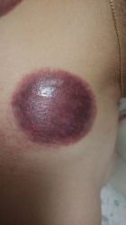 android_upload_pic-欧婼妍