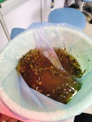 -德哥灰指甲脚气甲沟炎跖疣护理