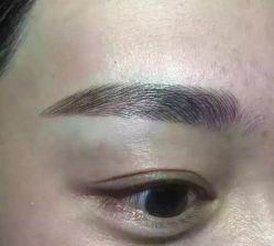 点击看大图 -郡艺医疗美容·微整·眼鼻吸脂