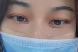体验后-天津伊美尔医疗整形美容专科医院