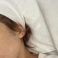 -慕颜医疗美容·皮肤微整 抗衰