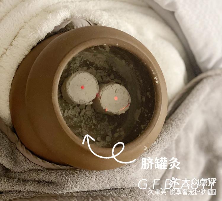 脐罐灸🉑排湿排寒,调理宫-大众点评