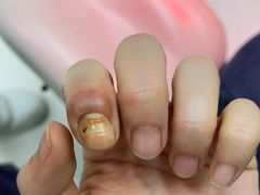 -新甲连锁灰指甲·甲沟炎·鸡眼(黑龙江路店)