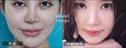 -北京丽星翼美医疗美容