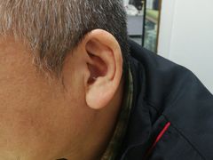 -宁耳听力助听器奥迪康·峰力·西门子(宝山店)