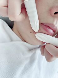 -SKIN79皮肤管理中心