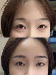 -张小野·专业半永久纹眉