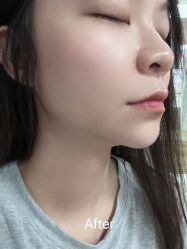 -广东韩妃整形外科医院