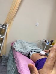 -苗塑堂减肥艾灸