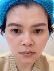 -深圳米兰柏羽医疗美容医院