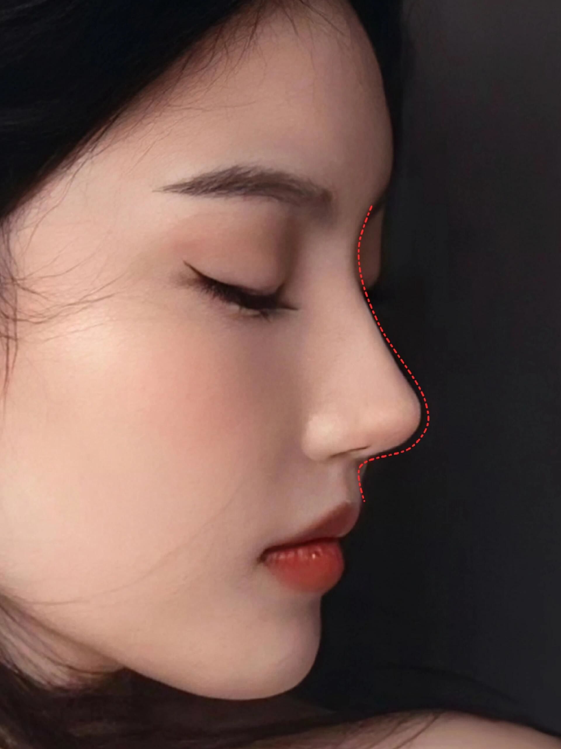 直鼻微翘有多美