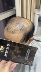 -发饰美男士增发补发假发定制店