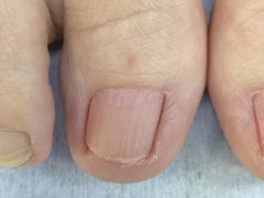 -Andrew指甲专科灰指甲·甲沟炎矫正·3D步态矫形鞋垫定制(上海法华镇路旗舰店)